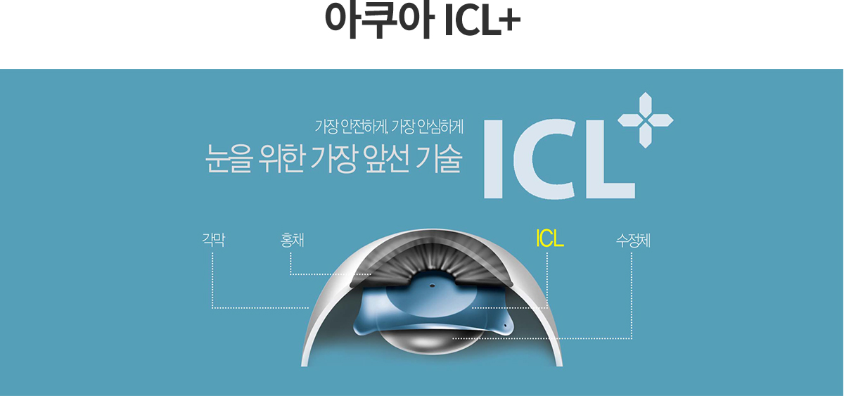 ICL/T-ICL렌즈
