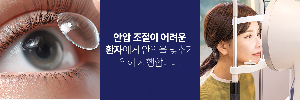 쳻 ġ Լ
